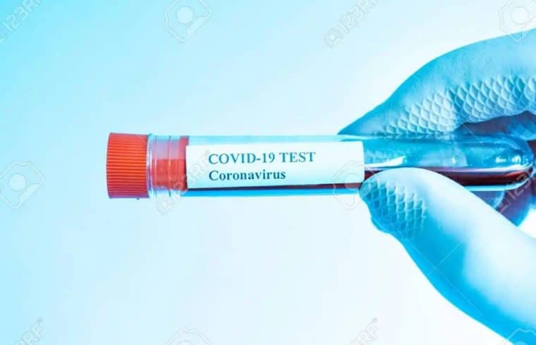 Coronavirus testing in Africa