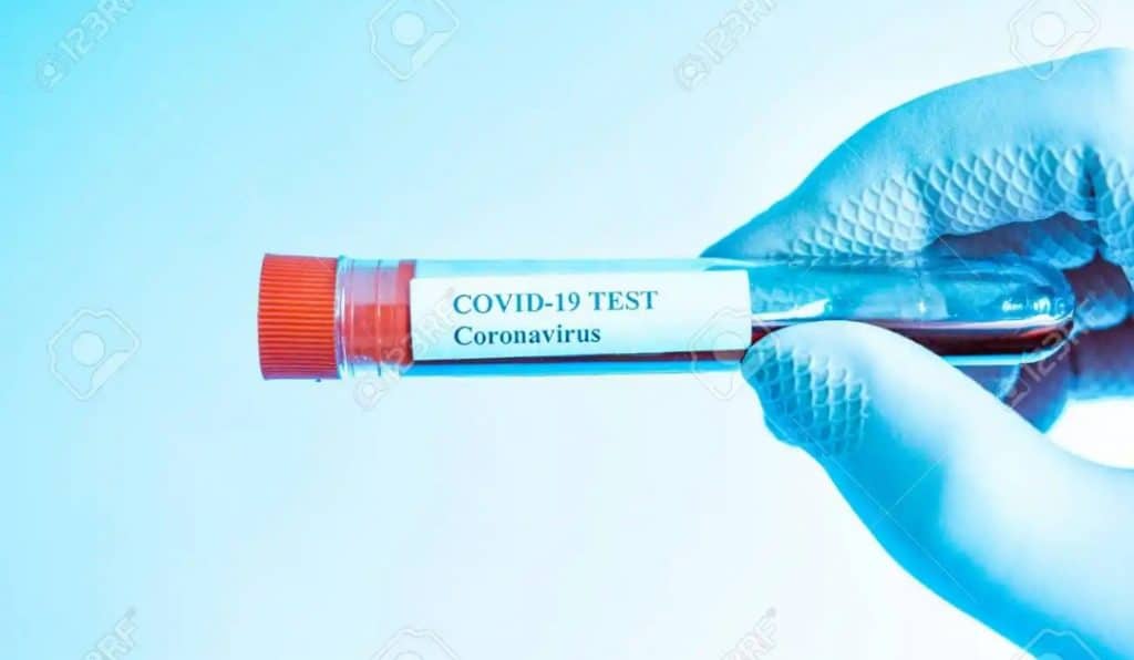 143423164 coronavirus test in laboratory covid 19 arm in plastic gloves holding test tube with test sample in 1590205201197