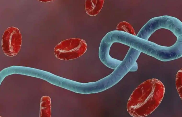 Ebola outbreak in DR Congo