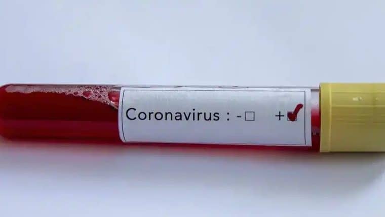 Coronavirus cases in Ghana top 23,000