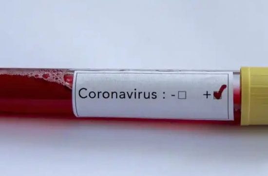 Coronavirus in Nigeria