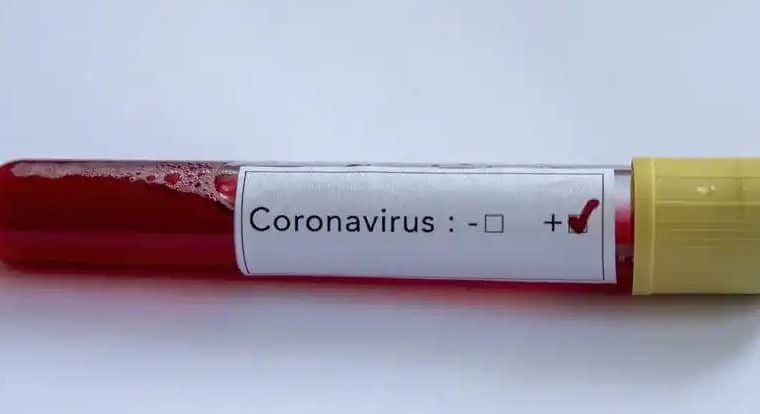 Ghana reports over 34,000 coronavirus recoveries