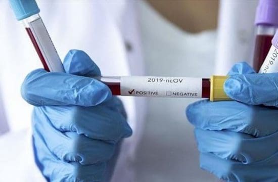 South Africa reports 2,810 new virus cases, 259 deaths