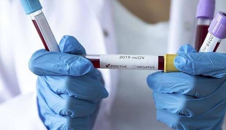 South Africa reports 2,810 new virus cases, 259 deaths